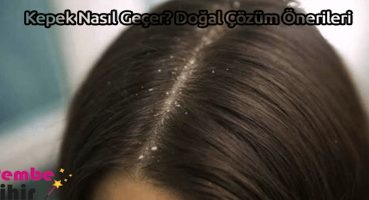 Kepek Nasıl Geçer? Doğal Çözüm Önerileri
