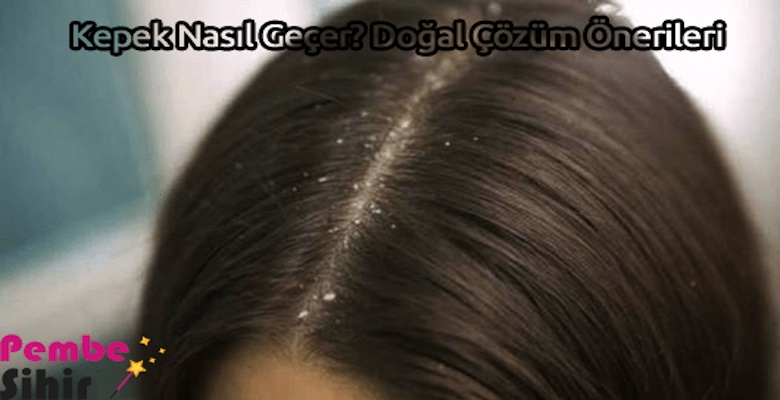 Kepek Nasıl Geçer? Doğal Çözüm Önerileri