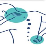 Boyun Fıtığı Ameliyatında Modern Yöntemler